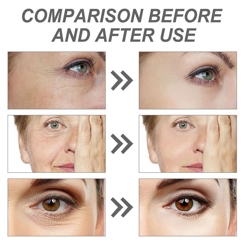 Sérum Facial de Retinol para R - The Ordinary Serum Hyaluronic Acid avaliação e preço