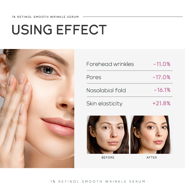 Sérum Suavizante de Rugas Quiy - The Ordinary Serum Hyaluronic Acid avaliação e preço